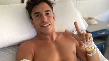 20/07/20 MOTOCICLISMO MOTOGP MARC MARQUEZ LESOIN ROTURA DE HUMERO OPERACION HOSPITAL FOTO ENVIADA MONICA.ARIAS. PUBLICADA 22/07/20 NA MA25 2COL