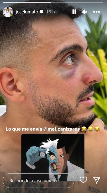 El vacile de Melanie Ca?izares a Joselu por un golpe en Balados