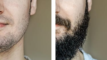 Los tres beneficios de usar aceite de romero (natural y anticaída) en tu pelo y barba