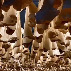 La operación estética que se expande entre los hombres: se les debe romper el fémur