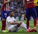Karim Benzema se lesionó en el derbi y hoy pasará pruebas