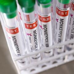 Viruela del mono en México: cuántos casos hay y qué medidas se van a tomar