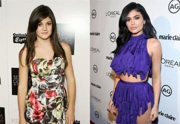 Al igual que su hermana, Kylie Jenner decidió resaltar su belleza con un par de cirugías estéticas.