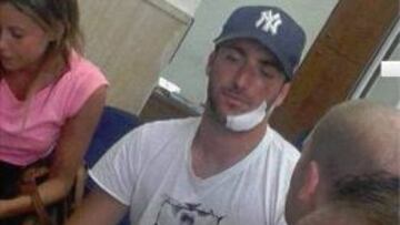 Higuaín, en el hospital tras golpearse contra una roca