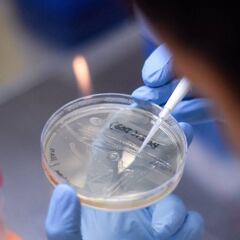 El coronavirus se podría transmitir hasta 90 días después de la infección