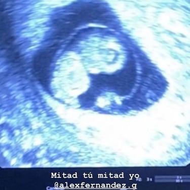 Alex Fernández y su esposa comparten primer ultrasonido de su bebé