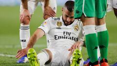 La férula de Benzema: se hace en 20 minutos y cuesta 40 euros