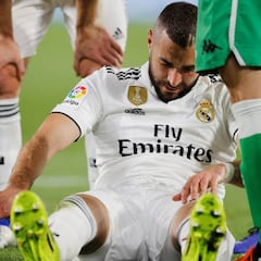 Benzema se retiró por una fractura del dedo meñique