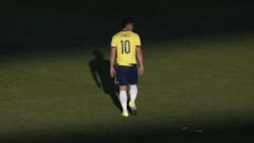 James se lesion&oacute; en el partido amistoso ante Per&uacute; en Nueva Jersey. 