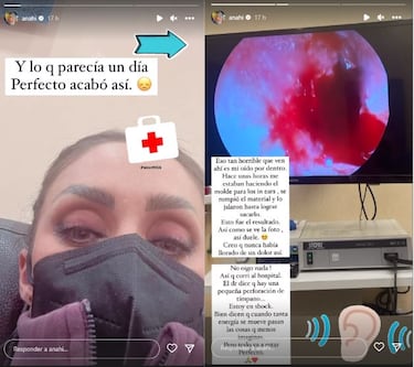Anahí sigue recuperándose del oído: ¿qué pasará con los conciertos de RBD?