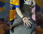 Afición de Tigres sale herida en el recibimiento de su equipo por falla en pirotecnia