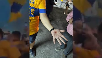 Afición de Tigres sale herida en el recibimiento de su equipo por falla en pirotecnia