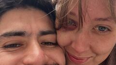 Actriz chilena denuncia a su pareja, también actor, por violencia de género: “Me pegó un cabezazo en el ojo y lo protegí”