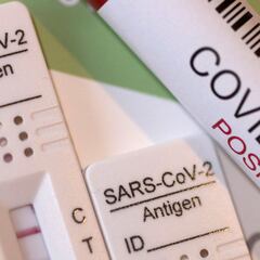 ¿Qué mide el test de antígenos y qué significa una línea tenue como resultado?