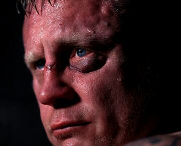 El BKB (Bare-knuckle boxing) es el deporte del boxeo sin el uso de guantes de boxeo u otro acolchado en las manos de los participantes.