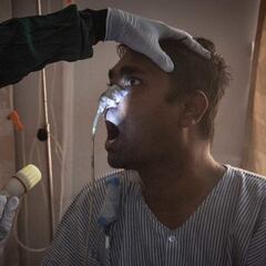 Estudio de UNAM señala que el hongo negro se encuentra en el ambiente