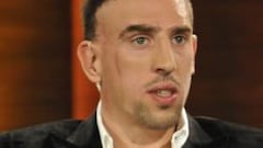 Ribéry sufrió de nuevo una lesión "misteriosa"