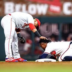 Braves infielder Ozzie Albies breaks finger in second game back