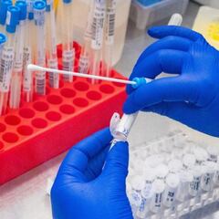 Viruela del mono en Colombia: cuántos casos confirmados hay y qué medidas se están tomando