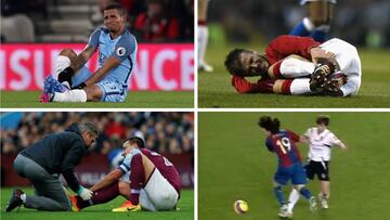 De Messi a Beckham: otras v¨ªctimas del quinto metatarsiano