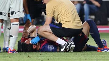 Soccer Football - Joan Gamper Trophy - FC Barcelona v AS Monaco - Estadi Olimpic Lluis Companys, Barcelona, Spain - August 12, 2024 FC Barcelona's Ilkay Gundogun receives medical attention after sustaining an injury REUTERS/Bruna Casas
