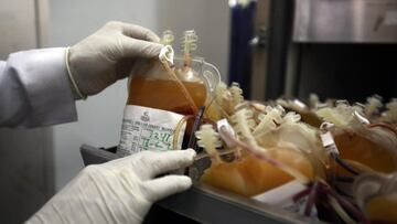 Las arterias podrían explicar por qué es menos agresivo el coronavirus en los niños