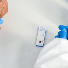Coronavirus en Colombia: cómo funcionan los test rápidos del Covid-19