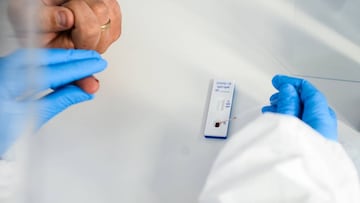 Coronavirus en Colombia: c&oacute;mo funcionan las pruebas r&aacute;pidas de detecci&oacute;n del Covid-19