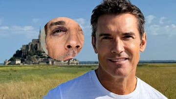 Jesús Vázquez sufre un “accidente veraniego” y se une al ‘club del ojo morado’