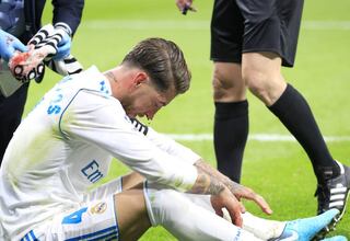 Por esto no se opera Sergio Ramos la nariz