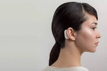 Así quedaría el implante una vez realizado. El cerebro de esa mujer ya estará expandido con un implante.