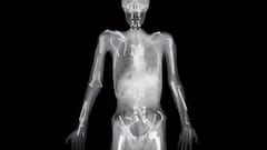 La radiografía viral de Travis Pastrana no es suya