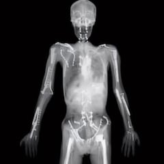 La radiografía viral de Travis Pastrana no es suya