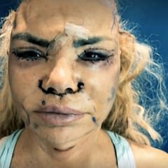 El impactante último retoque estético de Leticia Sabater por 15.000 euros