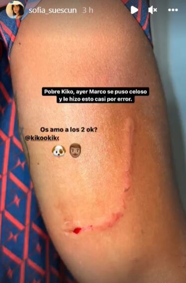 Kiko Jiménez es atacado por uno de los perros de Sofía Suescun