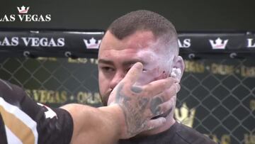 Le desfiguró la cara con un golpe: impacta ver cómo quedó...