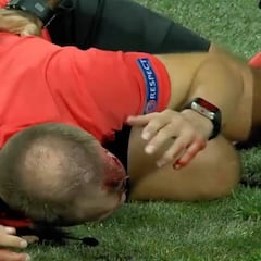 Hincha lanza una botella al juez de línea en Europa League