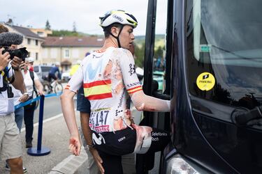 Ivan Romeo, llegó a meta con el lado derecho ensangrentado después de sufrir una caída durante la etapa 20 del Tour de Francia.