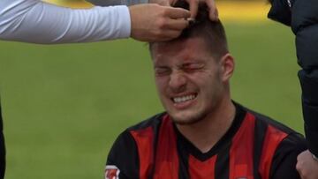 Jovic ha sido atendido con una herida en la cabeza.