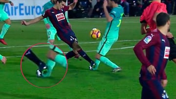 Lesión Busquets: esguince de ligamento lateral externo