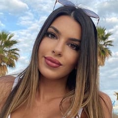 Andrea Gasca presume del resultado de su cirugía estética en Turquía