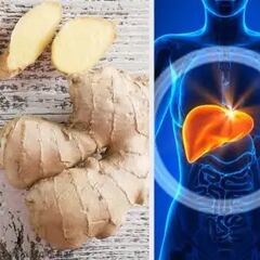 ¿Cómo evitar el hígado graso? Nutricionista explica qué deben comer y evitar las personas que lo padecen