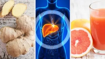 ¿Cómo evitar el hígado graso? Nutricionista explica qué deben comer y evitar las personas que lo padecen