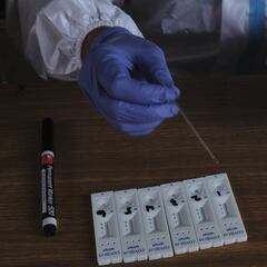 Cuatro síntomas digestivos se repiten en pacientes con COVID-19