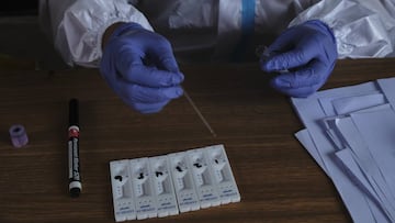 Cuatro s¨ªntomas digestivos se repiten en pacientes con COVID-19