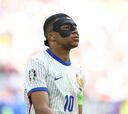 ¿Por qué juega con máscara Mbappé y hasta cuándo la tiene que llevar?