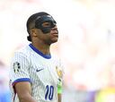¿Por qué juega con máscara Mbappé y hasta cuándo la tiene que llevar?