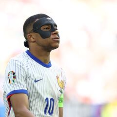 ¿Por qué juega con máscara Mbappé y hasta cuándo la tiene que llevar?