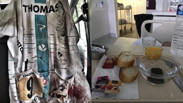 Geraint Thomas compartió cómo quedó su maillot tras su caída ayer en el Tour de Francia mientras Richie Porte mostró su desayuno en el hospital.