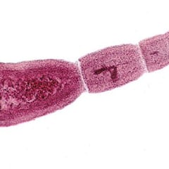 Canadá alerta de otra enfermedad potencialmente letal, la equinococosis alveolar
